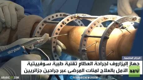 جهاز إليزاروف: أمل جديد للمرضى الجزائريين في استعادة الحركة