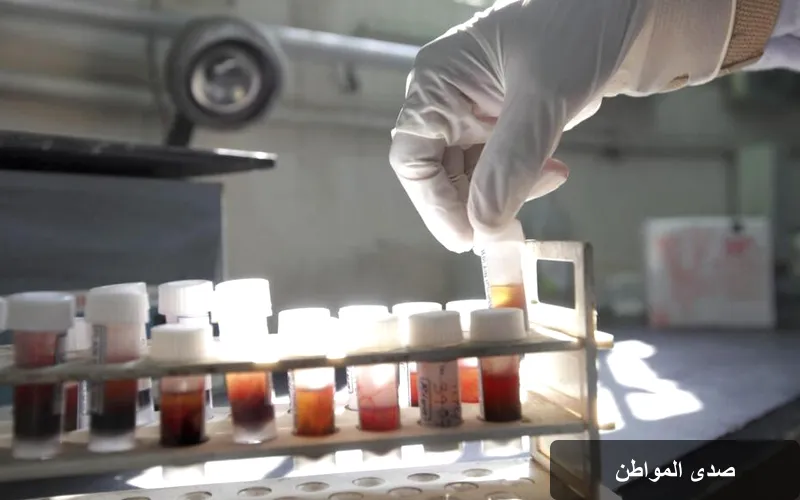 فحص دم مبتكر يكشف الزوائد اللحمية الخطرة قبل تحولها إلى سرطان القولون