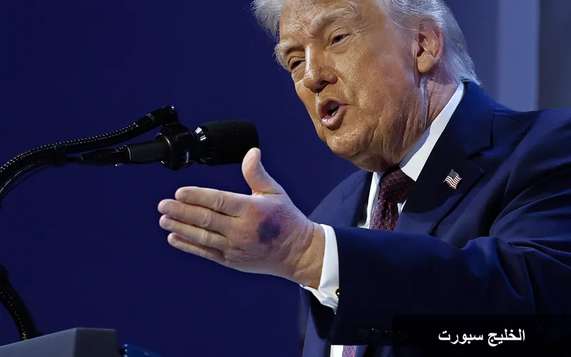 مخاوف من صحة ترامب: تساؤلات حول شفافية الرئاسة الأمريكية